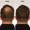 ⁦Crazy Nash Hair Fiber⁩ - الصورة ⁦2⁩